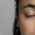 Foto em close-up de uma mulher com a pele visivelmente rejuvenescida após tratamento com laser Hybrid CO2 na região dos olhos.