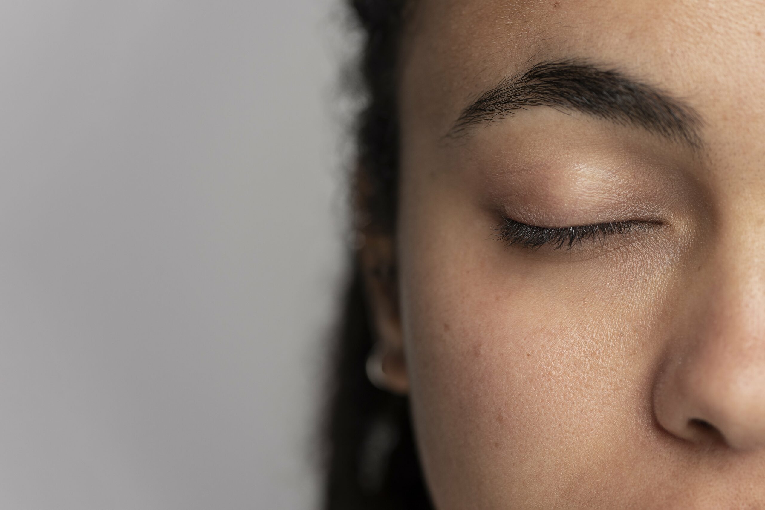 Foto em close-up de uma mulher com a pele visivelmente rejuvenescida após tratamento com laser Hybrid CO2 na região dos olhos.